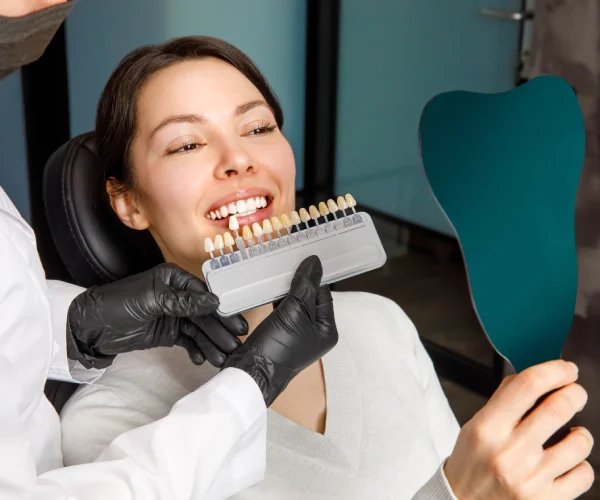 Precio carillas dentales cuernavaca